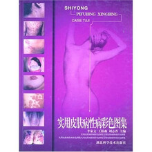 实用皮肤病性病彩色图集