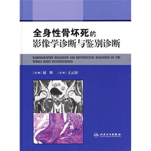 全身性骨坏死的影像学诊断与鉴别诊断
