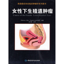 女性下生殖道肿瘤