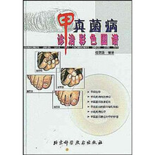 甲真菌病诊治彩色图谱