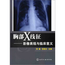 胸部X线征：影像表现与临床意义