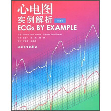 心电图实例解析（第2版）