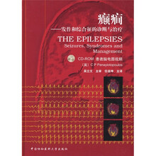 癫囗:发作和综合征的诊断与治疗(附光盘)