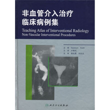 非血管介入治疗临床病例集
