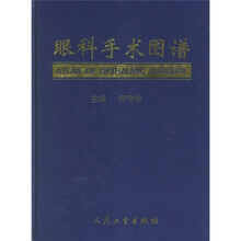 眼科手术图谱
