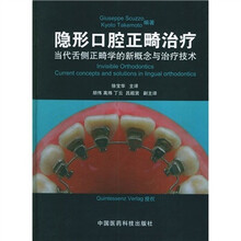 隐形口腔正畸诊疗
