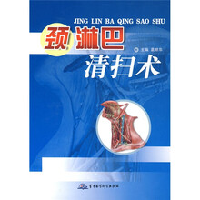 颈淋巴清扫术