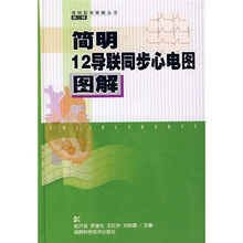 简明12导联同步心电图图解