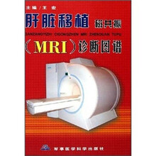 肝脏移植磁共振（MRI）诊断图谱