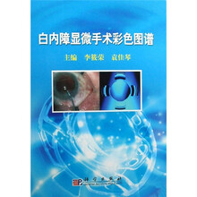 白内障显微手术彩色图谱