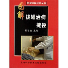 图解拔罐治病捷径