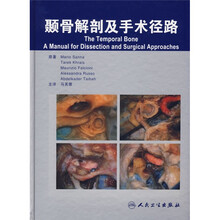 颞骨解剖及手术径路