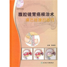 腹腔镜胃癌根治术淋巴结清扫技巧(配盘)