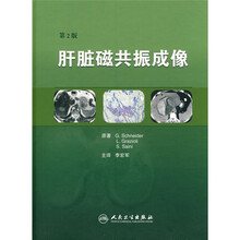 肝脏磁共振成像