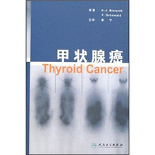 甲状腺癌