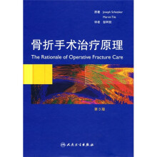 骨折手术治疗原理(第3版)