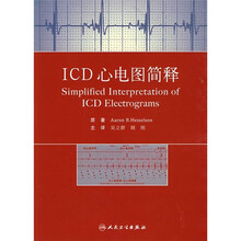 ICD心电图简释