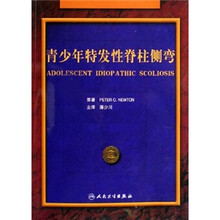 青少年先天性脊柱侧弯