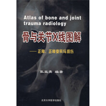 骨与关节X线图解：正常、正常变异与损伤