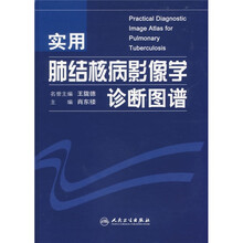 实用肺结核病影像学诊断图谱