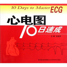 心电图10日速成