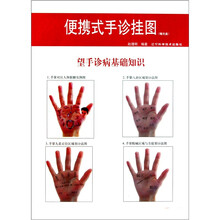 便携式手诊挂图（赠光盘1张）