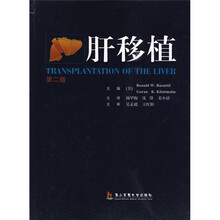 肝移植（第2版）