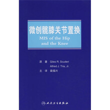 微创髋膝关节置换
