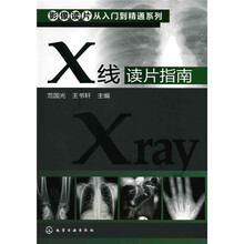 X线读片指南