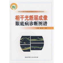 相干光断层成像眼底病诊断图谱