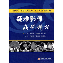 疑难影像病例精析