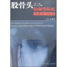 股骨头缺血性坏死的修复与再造(第2版)