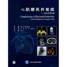 心肌梗死并发症:临床诊断图谱