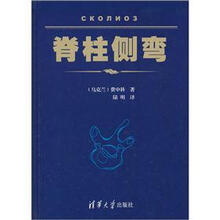 脊柱侧弯