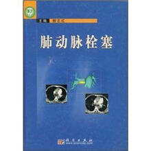 肺动脉栓塞
