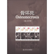 骨坏死