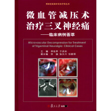 微血管减压术治疗三叉神经痛：临床病例荟萃
