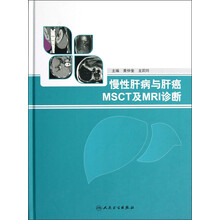 慢性肝病与肝癌MSCT及MRI诊断