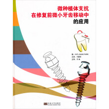 微种植体支抗在修复前微小牙齿移动中的应用