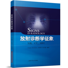 放射诊断学征象：X线、CT、MRI