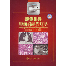 影像引导肿瘤消融治疗学