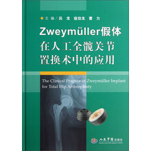 Zweymǘller假体在人工全髋关节置换术中的应用