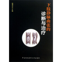 下肢静脉曲张的诊断与治疗