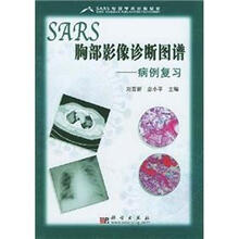 SARS胸部影像诊断图谱：病例复习