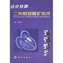 经皮穿刺二尖瓣球囊扩张术