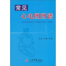 常见心电图图谱