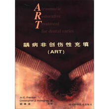 龋病非创伤性充填（ART）