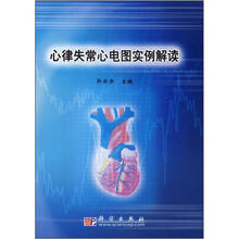 心律失常心电图实例解读