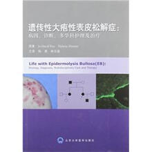 遗传性大疱性表皮松解症:病因、诊断、多学科护理及治疗
