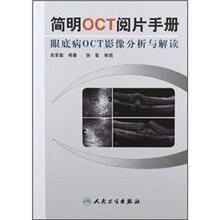 简明OCT阅片手册：眼底病OCT影像分析与解读